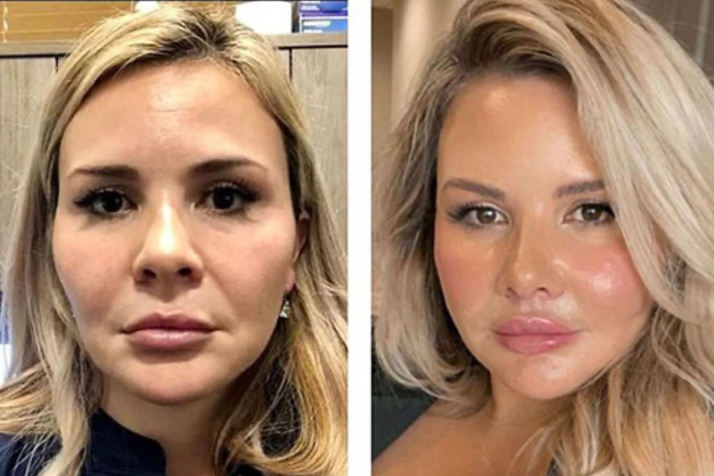 Cosmetic-Surgery-img