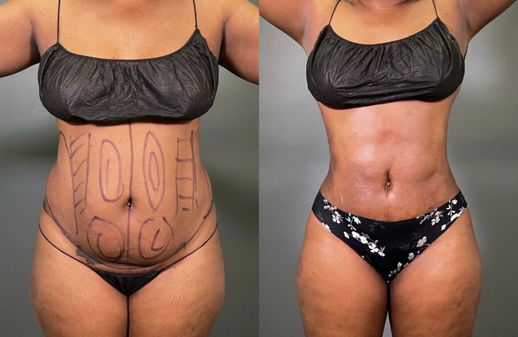 Cosmetic-Surgery-update