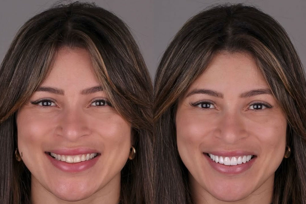 dental-implement-img